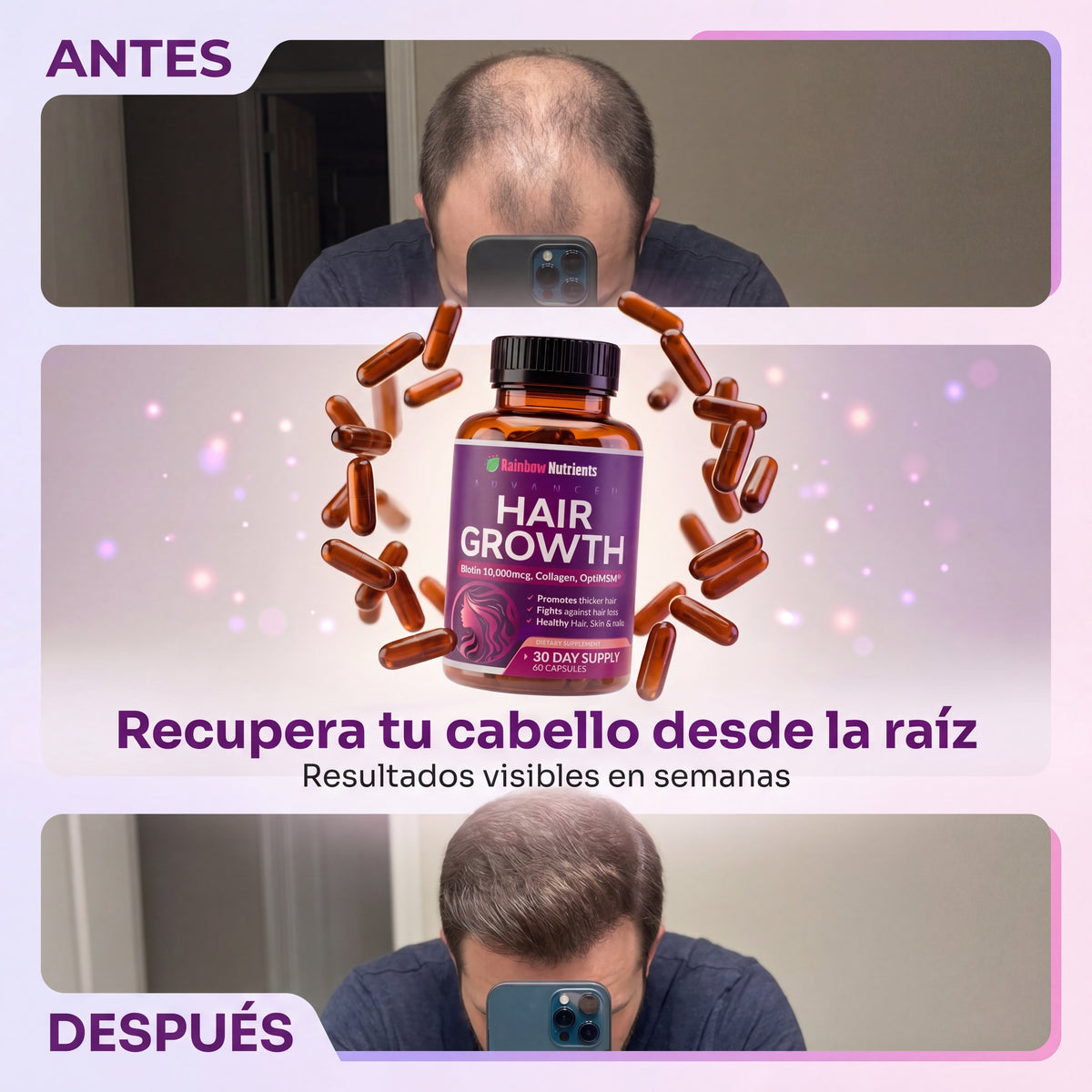 Vitaminas Hair Growth